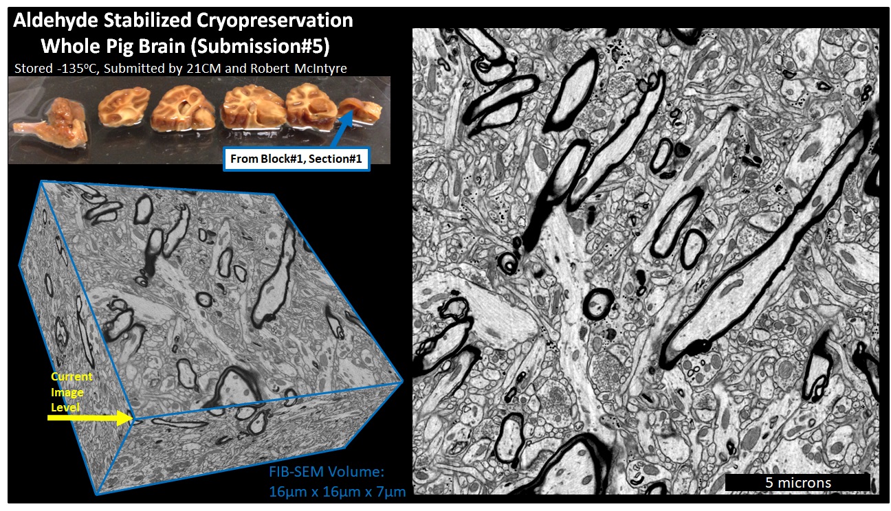 FIB-SEM volume overview — Block 1, Section 1