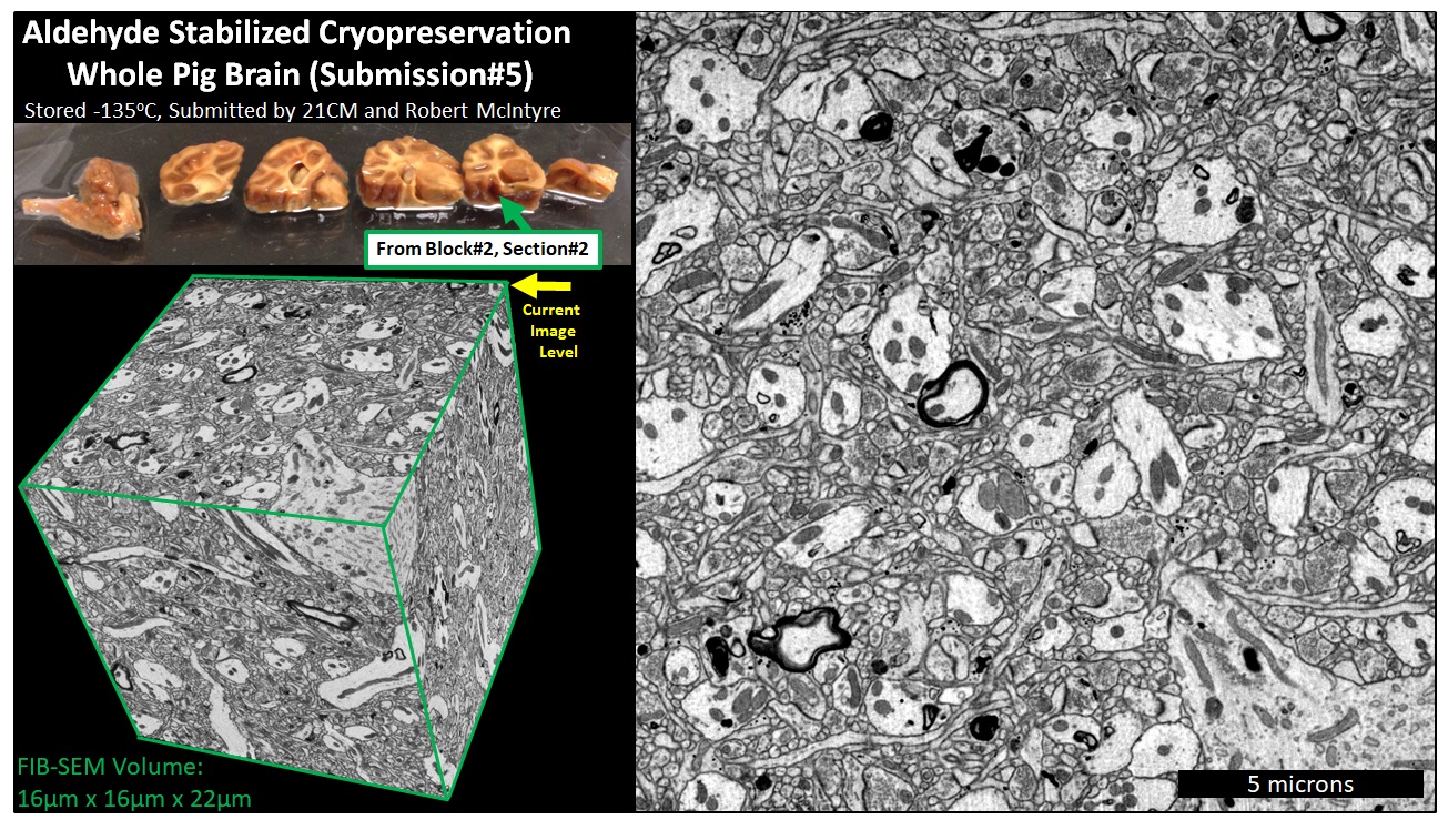 FIB-SEM volume overview — Block 2, Section 2