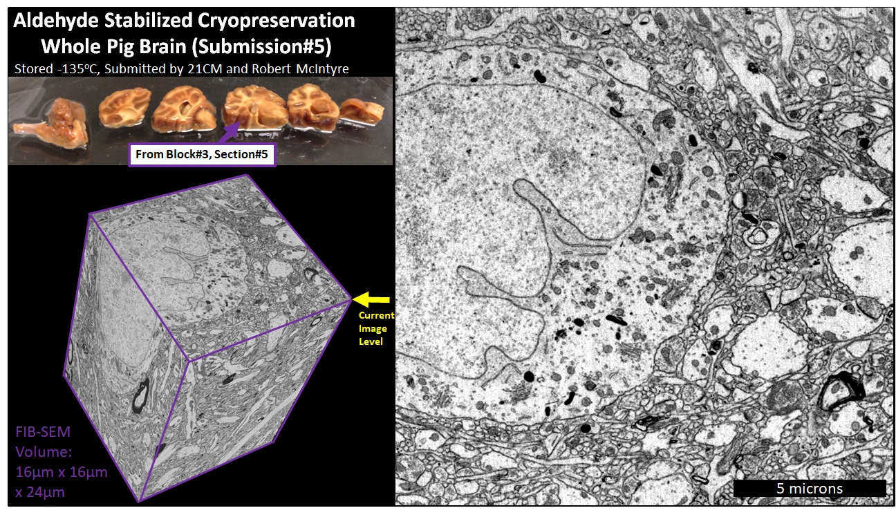 FIB-SEM volume overview — Block 3, Section 5