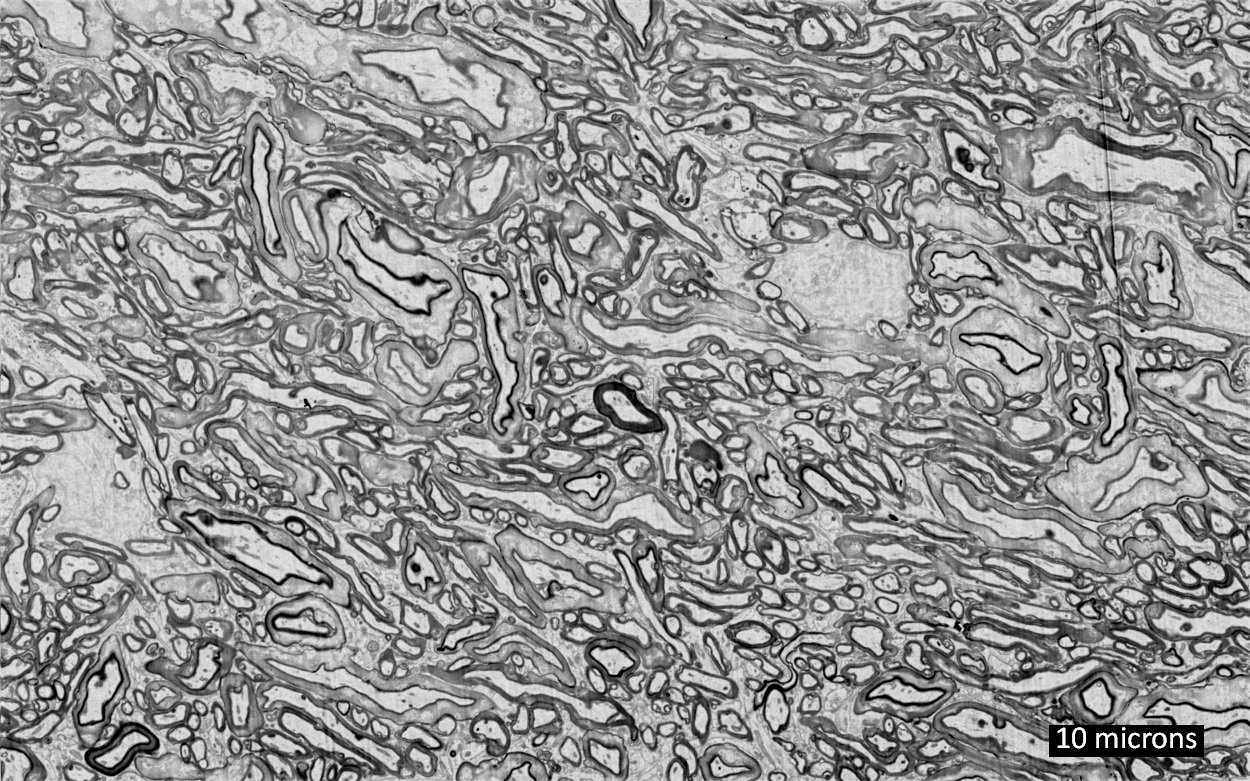 Representative electron micrograph of white matter region