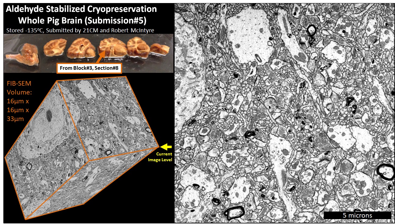 FIB-SEM volume overview — Block 3, Section 8