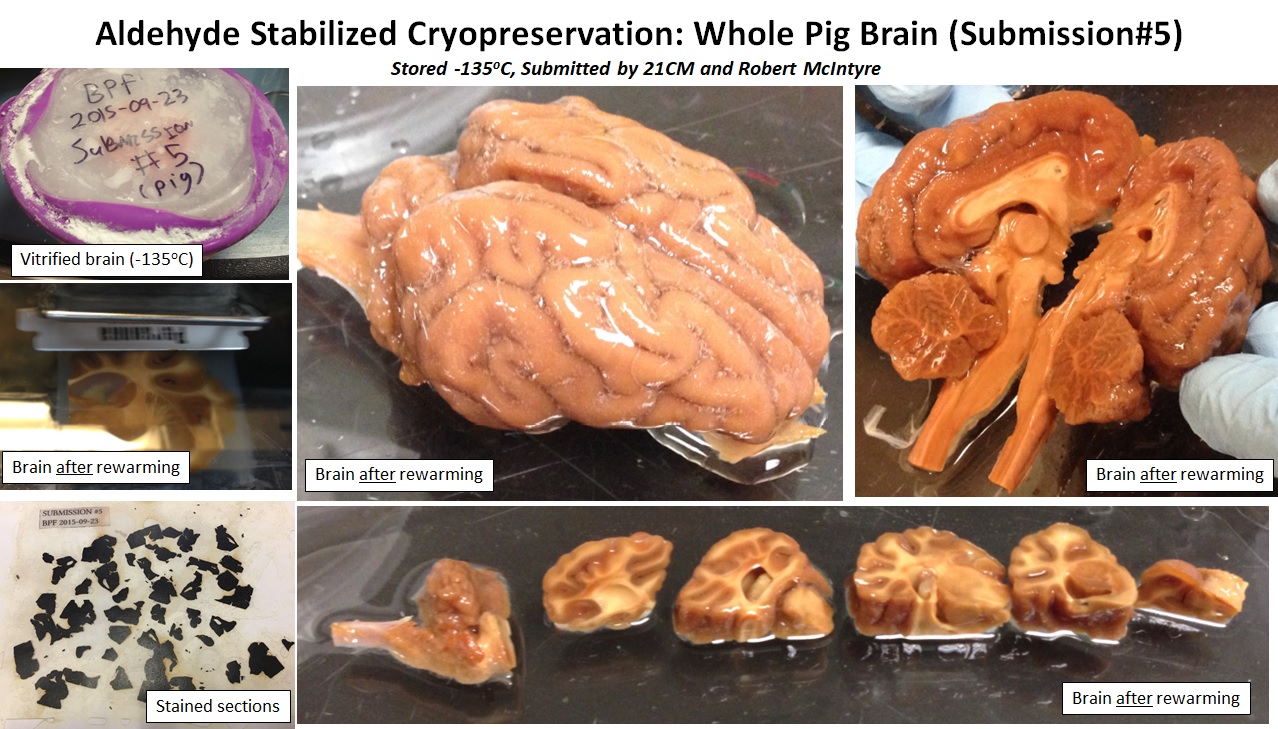 Images of ASC-preserved pig brain dissection